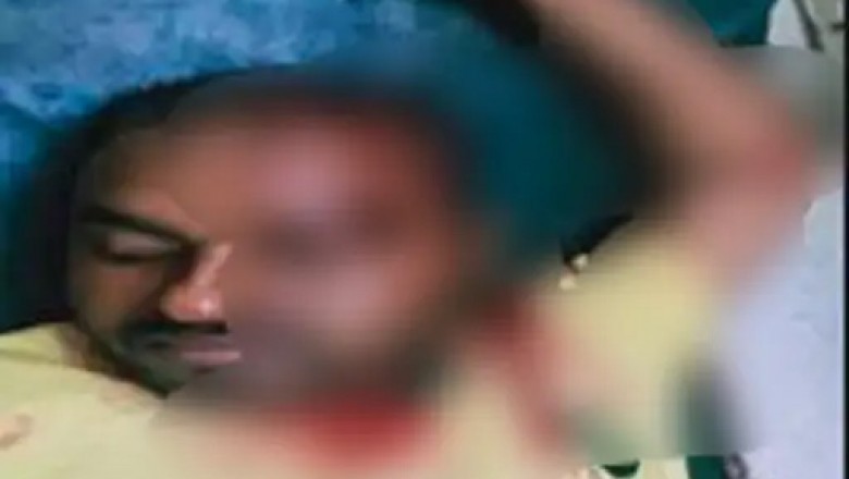 छत्तीसगढ़- दुर्गा विसर्जन देखने गए परिवार पर हमला…. पत्नी और साली को देखकर बदमाशों ने किया कमेंट, मना करने पर जमकर की मारपीट; 4 लोग गंभीर