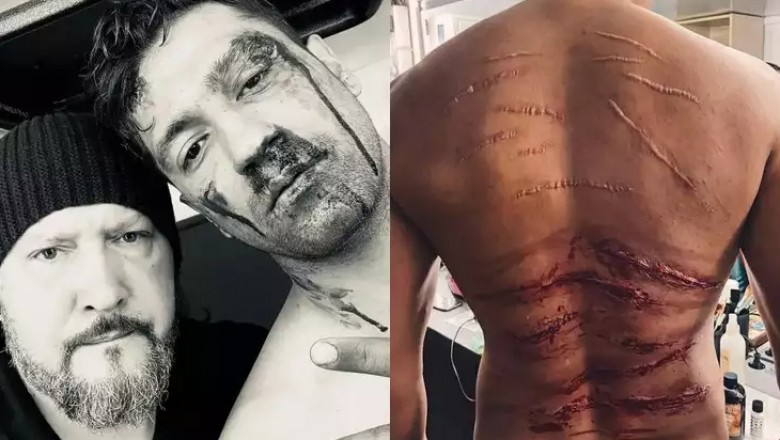 सरदार उधम:विक्की कौशल ने पोस्ट शेयर कर फिल्म में अपने घायल लुक के पीछे के शख्स का किया खुलासा