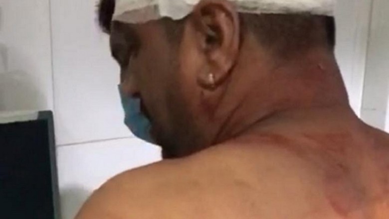 सांसद सरोज पांडेय और उनके भाई के गुट भिड़े; एक-दूसरे को पीटा, महामंत्री का सिर फोड़ा