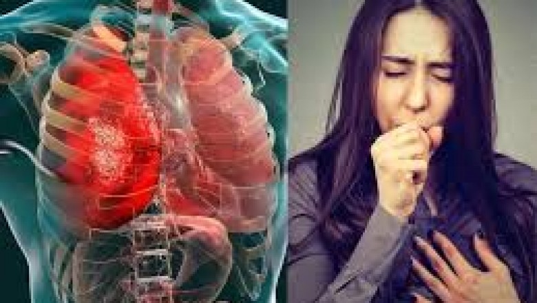 प्रदेश में टीबी के अति संवेदनशील समूह का होगा मानचित्रण :महीने भर शहरों की मलिन बस्तियों में चलेगा अभियान