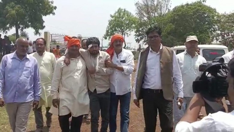 भाजपा-कांग्रेस के कार्यकर्ताओं के बीच झड़प  :