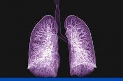 निक्षय मित्र बनकर टीबी मरीजों को दिया जा रहा नि:शुल्क पोषण आहार :