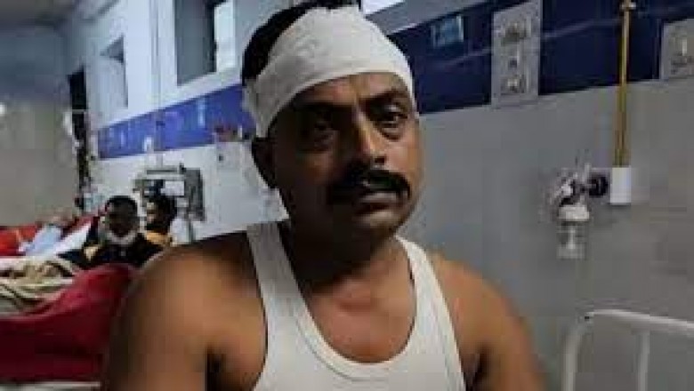 भिलाई नगर में बकरा-दारू पार्टी के दौरान विवाद :आरक्षक के बेटों ने एएसआई को हॉकी स्टिक-राड से जमकर पीटा..
