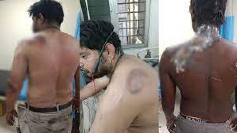 ACB पावर प्लांट में बड़ा हादसा : बॉयलर फटने से 5 मजदूर गम्भीर रूप से घायल...मचा हड़कंप....
