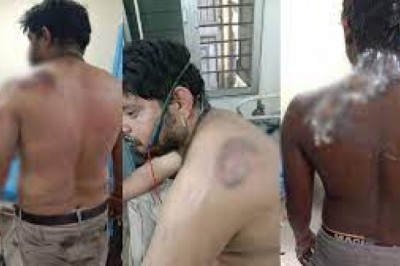 ACB पावर प्लांट में बड़ा हादसा : बॉयलर फटने से 5 मजदूर गम्भीर रूप से घायल...मचा हड़कंप....