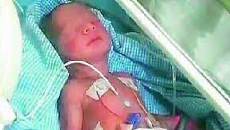 कचरा संग्रहण के पास जिंदा नवजात बच्चा मिलने से इलाके में हड़कंप