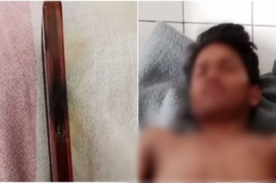 अचानक ब्लास्ट के बाद हुआ ये हाल, सावधान! चार्जिंग के दौरान मोबाइल पर बात करना युवक को पड़ा भारी