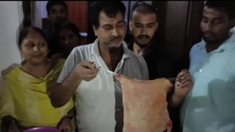 डॉक्टरों ने कर दिया था बड़ा कांड : डिलीवरी के बाद घर जाते ही महिला को होने लगा पेट दर्द...