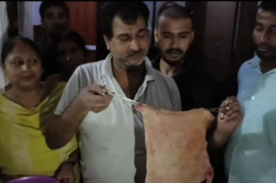 डॉक्टरों ने कर दिया था बड़ा कांड : डिलीवरी के बाद घर जाते ही महिला को होने लगा पेट दर्द...