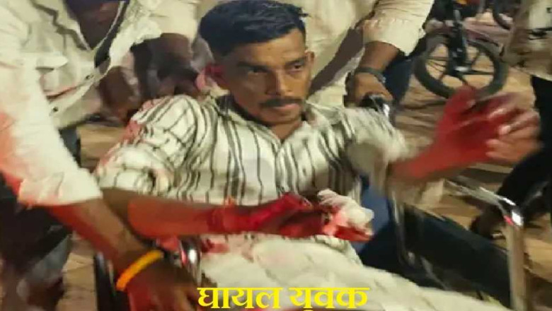 भिलाई में डिलीवरी बॉय दोस्त पर शराब के नशे में कटर से हमला, युवक के प्राइवेट पार्ट और उंगली पर आई गंभीर चोटें , पब्लिक का गुस्सा फूटा आरोपी की जमकर की पिटाई....