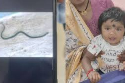 डॉक्टर हैरान : 9 माह की मासूम बच्ची खिलौना समझ कर सांप से खेल रही थी ,बच्ची के काटते ही मर गया ज़हरीला सांप...