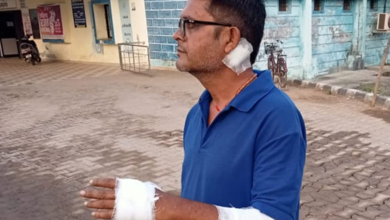 फर्जी लाइट बेचने वाले दुकानदार ने पत्रकार पर किया जानलेवा हमला....