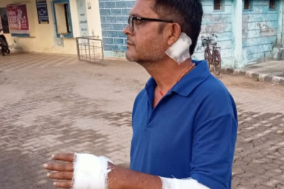 फर्जी लाइट बेचने वाले दुकानदार ने पत्रकार पर किया जानलेवा हमला....