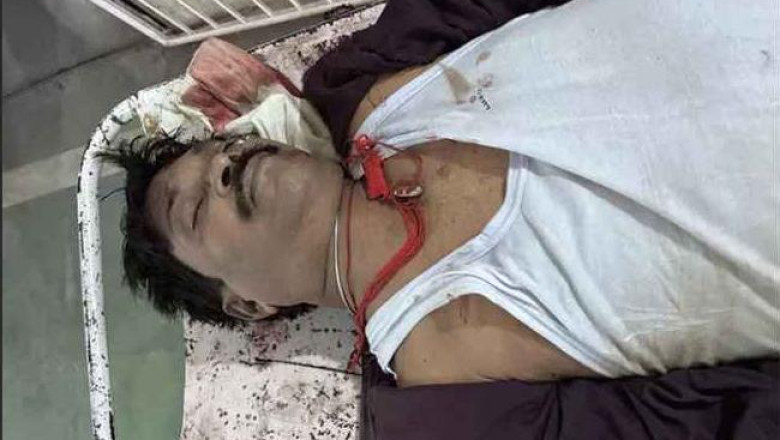 दुर्ग में कार ने कुचला, सरगुजा में बाइकों की भिड़ंत: सड़क हादसों में 4 की मौत