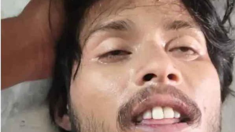 भिलाई होटल में युवक की संदिग्ध मौत: गर्लफ्रेंड के साथ ठहरा था, परिवार ने उठाए सवाल