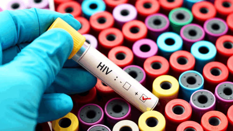 छत्तीसगढ़ में HIV मरीजों को बड़ी राहत: 18 हजार मरीज डेंजर जोन से बाहर, समय पर जांच-दवा का असर